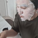 서피부과의원 | 김재준 피부과의원 | 오픈런 | 관악구 서울대입구 피부과 점제거 성지 | 샤로수길