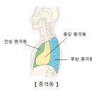 종격동염[Mediastinitis]호흡기질환 이미지