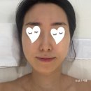 호계동 피부관리 | 스킨리벨럽(구. 스킨디벨럽) 베이직 케어 60분 1회 (페이스, 데콜테) 1:1 관리 후기