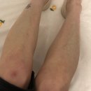 여름숲 | 해운대왁싱 아리아숲왁싱｜여름 대비 다리왁싱 후기 (안 아프고 깔끔한 곳 찾았다!)