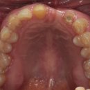 블루커스텀 치과기공소 이미지