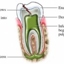 보강치과기공소 이미지
