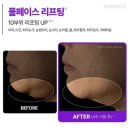 <쿠팡템>20대 30대 피부좋아지는법 쿠팡화장품 또산집 “마데카크림”솔직한후기