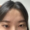 유니뷰티랩 | 노원 속눈썹펌 유니컬뷰티랩/ 속눈썹 연장 시술 후기