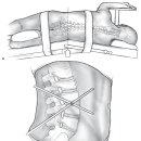 Try MedOne - Access free content from the MedOne Neurosurgery Playlist 이미지