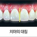 스마일라인 치과기공소 네이버블로그