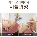 아그네스 이미지