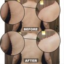 부산피부관리 서면에스테틱 신부관리샵 추천 라비드에스떼