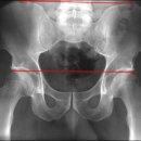 장정형외과의원 이미지