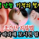 이명 난청 기적의 혈자리(유튜브) 이미지