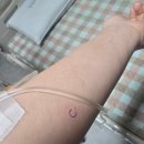 청주혜성외과의원 | 맹장염 수술후기 청주제일외과 충수염