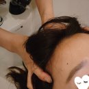 진성프라자 | 인천두피케어: 청라 모스테틱, 헤드스파 두피마사지 스케일링 후기