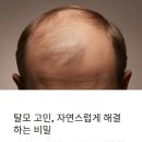 두피관리,탈모고민,자연스럽게 커버하는 방법은? 이미지
