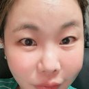 셀피성형외과 | 신사역 성형외과 스킨부스터 후기 ㅅㅅ