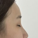 페르마타 | 검단 속눈썹펌 페르마타뷰티 클리닉케라틴펌 후기