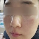 필앤필의원 | [W13]유앤아이 의원 안양점 라라필+포텐자+쥬베룩4cc+LDM 1회차 내돈내산 후기