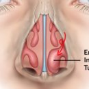 목동센트럴이비인후과의원 이미지