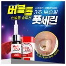 미라클 네일