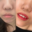 4435 | 영등포입술 반영구 솔직 후기 / 립 컬러 / 통증 / 후관리까지!