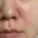 최피부과의원 이미지