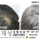 모재성성형외과의원 이미지