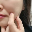 프라임성형외과의원 | 미니거상 대신 레이저 ｜수면마취 울쎄라 피프라임600샷+온다 50줄 레이저리프팅내돈내산후기