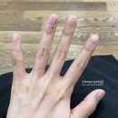예손약국 | 10년도 더 앓은 사구체종양 당일 수술기 (@부천예손병원)