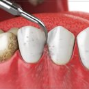 강동뉴욕치과의원 이미지