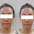 보인한의원 | #서울강남 안면비대칭한의원 &#39;십장생한의원&#39;