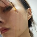 부활약국 | [부활앰플] 화석기미 고민 끝! 기미없애는 법으로 선택한 메라블 앰플 2주 사용 리얼 후기
