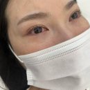 쌩얼  EYE LASH | 대전 대흥동 속눈썹펌 ‘아이러뷰티’ 듀얼 속눈썹펌 후기