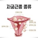 한화호텔앤드리조트(주)부산대병원직원식당 | 부산대 자궁근종 수술 후기-수술 전 (feat.첫 MRI,수혈 경험)