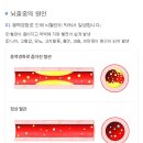 행콩짐 이미지