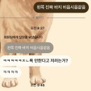 지투사인 | 세미정병 걸린 소녀의 일상