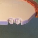 지안치과기공소 이미지