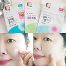 케어플러스메디칼(주) | 케어플러스 NEW 트러블 흔적 패치 2주 사용 후기