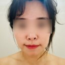 운양동 림프윤곽관리 얼굴소멸맛집! 창조테라피 다녀온 솔직 후기 💆🏻‍♀️✨
