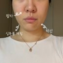 홈케어 리프팅 EOA 장나라 풀쎄라 프로 내돈내산 2개월 후기 +사용방법, 통증, 비포애프터