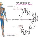 발등이 이유없이 붓거나 원인을 찾기 어려운 때 이미지