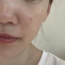 리마인드피부과의원 | 송도피부관리 예쁘다에스테틱 1:1 맞춤 EXTER 집중 케어로 피부 퀄리티 최상