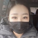 아름다운눈안과의원 | 안성형 전문 전주 김현숙안과에서 쌍꺼풀 수술받은 7일간의 리얼후기