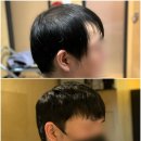 박승철위그스투디오부평점인천가발 | 동인천 가발 동안만들기