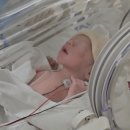 11650-17-33-8 | [임신 33주차] 임신중독증 (전자간증), 응급제왕 출산 후기