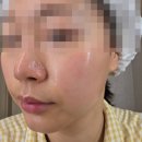 뷰티디바이스 오큐라 티타늄셀 내돈내산 후기