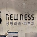 수원 뉴니스의원 내돈내산 광대축소레이저 솔직후기
