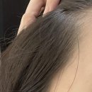 [분당/정자] &#34;헤드샷스칼프 본점&#34;에서 헤어라인 교정 받은 후기 (분당 smp, 강남 smp)