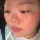 깔끔피부관리 | 부천 신중동 블랙헤드 피부관리, 모공까지 깔끔하게 관리받은 후기