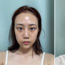 유니풀의원 이미지