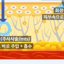 본피부과 이미지