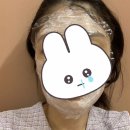 센텀린의원 | 서면 제이린 이마 보톡스 및 스킨 보톡스 후기